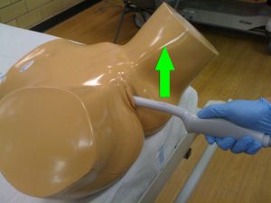Transvaginal ultrasound approach- longitudinal