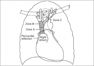 zones