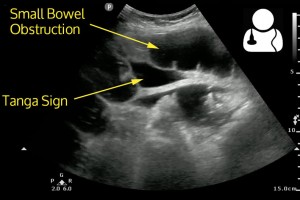 uotw20-tanga