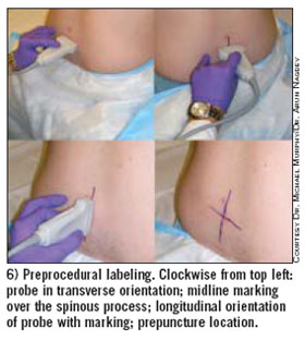 Image taken from www.acep.org