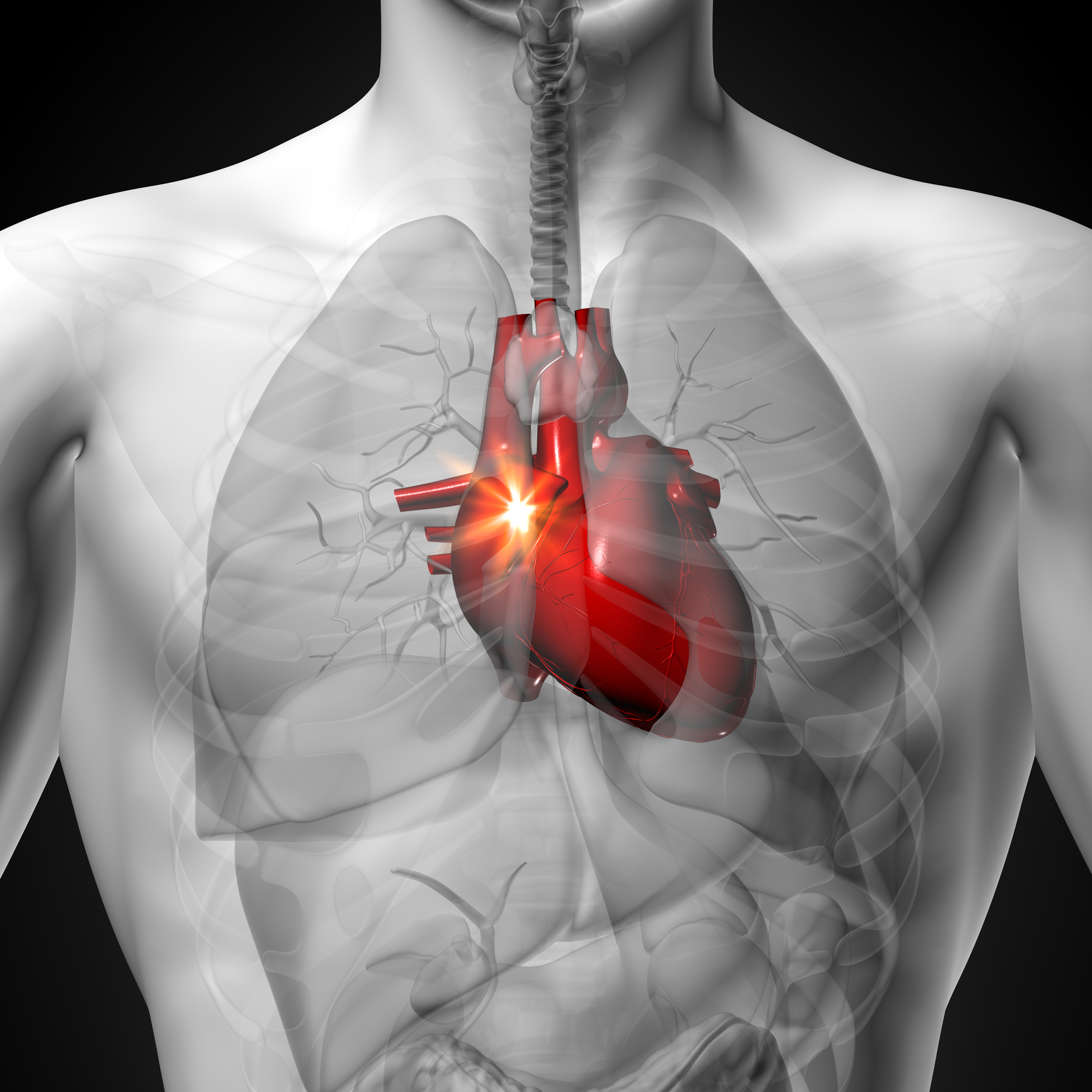 does glipizide cause heart palpitations