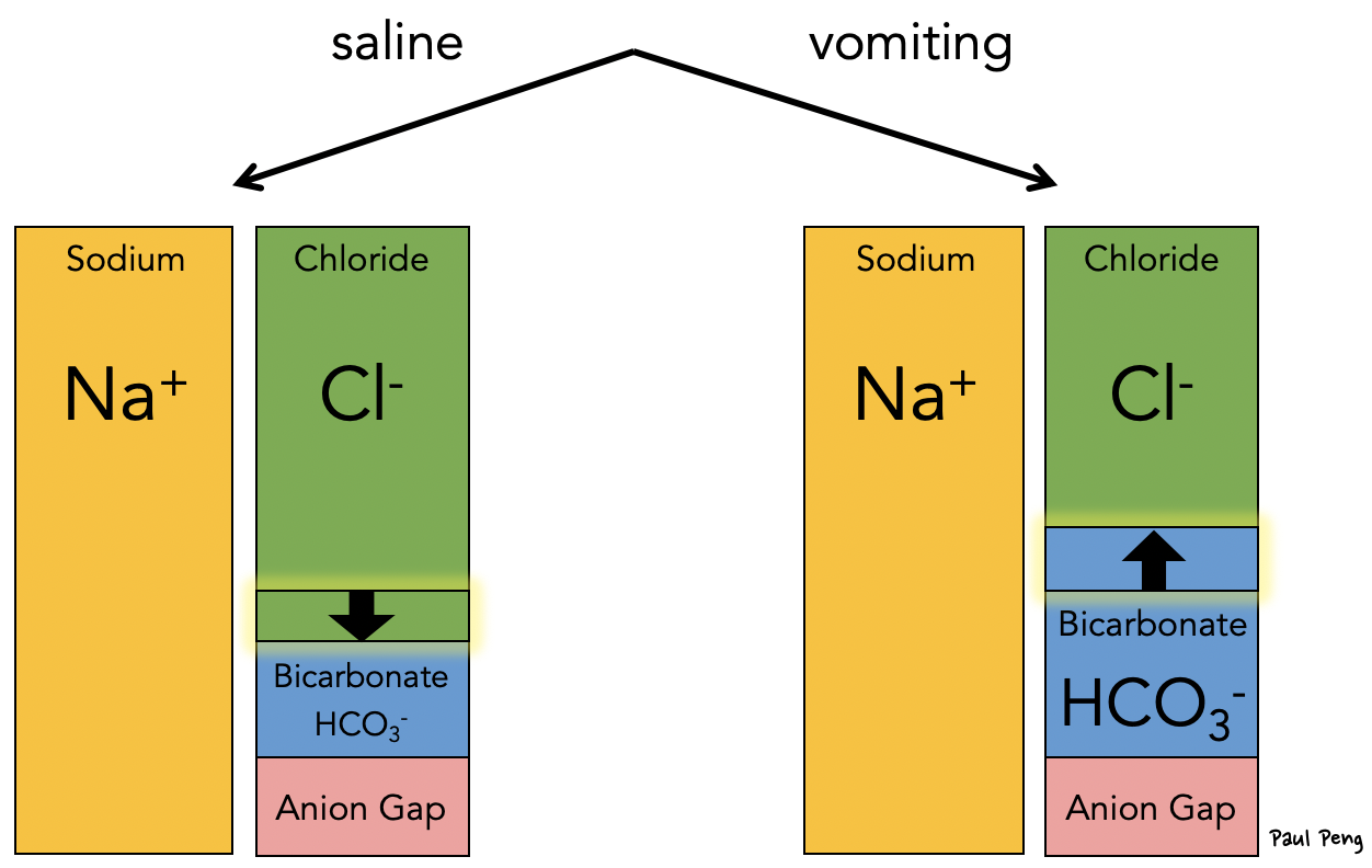 gapped acidosis